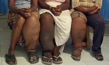 Hari abaturage bavuga ko batazi ibijyanye n'indwara y'imidido uko yandura ndetse n’uko bayivuza