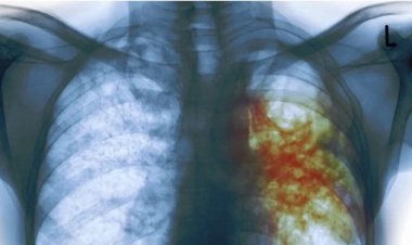 Imyumvire, kutagira amakuru: zimwe mu mpamvu zituma igituntu kidacika.