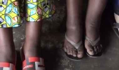 Inzego z’ibanze zirasabwa kugira uruhare mu kwita ku ndwara zititaweho nk’imidido.