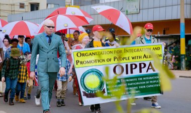 Imiryango y’abafite ubumuga bw’uruhu mu Rwanda ikomeje gukora ubuvugizi mu nzego zitandukanye