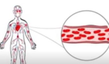 Bahangayikishijwe n’indwara y’umuvuduko w’amaraso