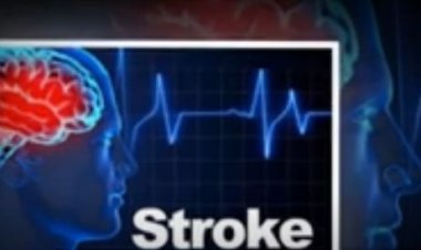 Rwandans do not have sufficient knowledge about the disease stroke, says NTAGANDA Evariste-RBC