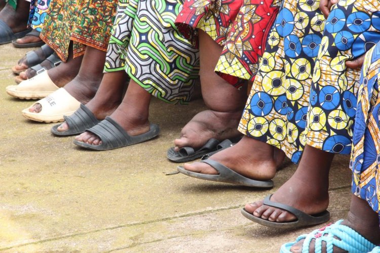 Rubavu: Abarwayi b'imidido barashima ubufasha bw'ubuvuzi bahawe