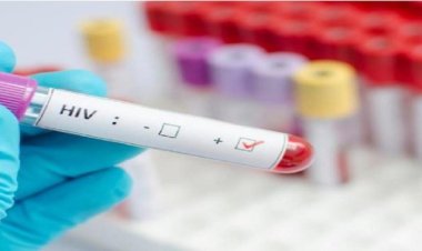 Ufite virusi itera SIDA n'utayifite barashyingiranwa bakabana neza ntawanduje undi