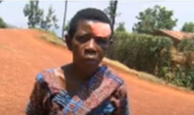 Kigali- Jali: Barasabira ubutabera umuturage wakubitiwe mu nteko y'abaturage