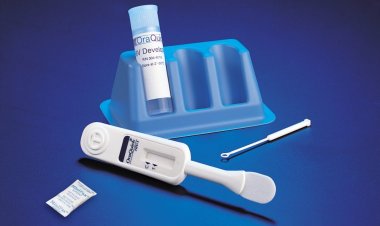 Urubyiruko rurasaba ubukangurambaga ku buryo bwo kwipima SIDA