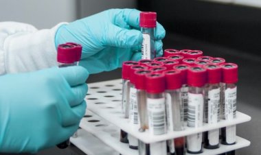 Barinubira amwe mu mavuriro akorera inyungu zayo kurusha ababagana