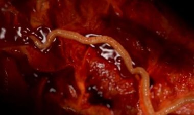 Rubavu: Baretse gukoresha ifumbire yo mu musarani bigabanya umubare w’abarwara inzoka