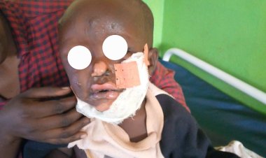 Gicumbi: Umubyeyi n’umwana batwikiwe mu nzu hakoreshejwe peteroli