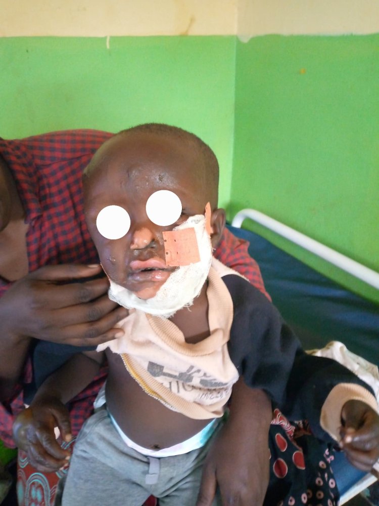 Gicumbi: Umubyeyi n’umwana batwikiwe mu nzu hakoreshejwe peteroli