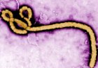 Amerika yatangaje inkunga ya miliyoni $13 yo guhangana na Ebola muri RDC na Uganda
