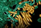 Ebola yongeye kwaduka mu Burasirazuba bwa RDC, impungenge z’ikwirakwira ryayo ziriyongera