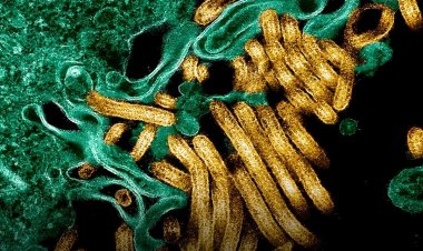 Ebola yongeye kwaduka mu Burasirazuba bwa RDC, impungenge z’ikwirakwira ryayo ziriyongera