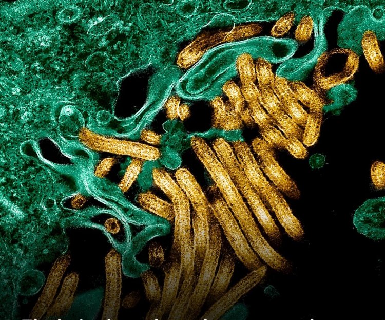 Ebola yongeye kwaduka mu Burasirazuba bwa RDC, impungenge z’ikwirakwira ryayo ziriyongera